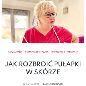 Infografika USG Barbara Pardo Marcin Ambroziak